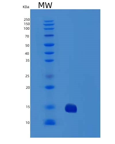Human TNFRSF10B (Tumor Necrosis Factor Receptor Superfamily Member 10B) - Recombinant Protein