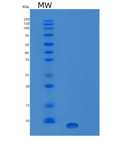 Human IGF1 (Insulin-Like Growth Factor 1) - Recombinant Protein