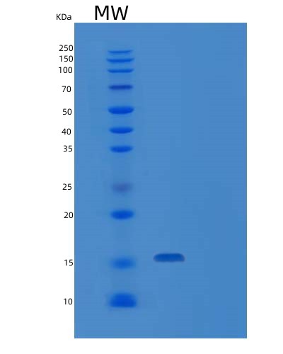 Human IFNG (Interferon Gamma) - Recombinant Protein