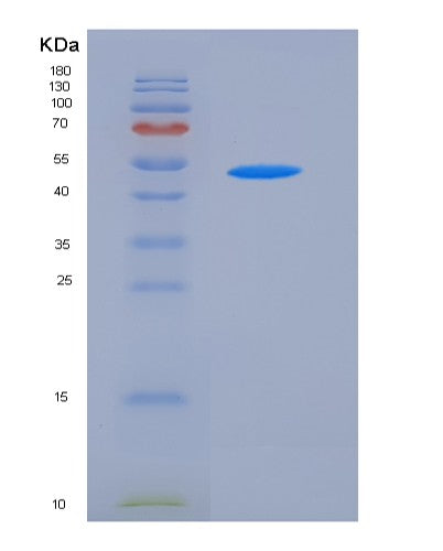Mouse Kynu (Kynureninase) - Recombinant Protein