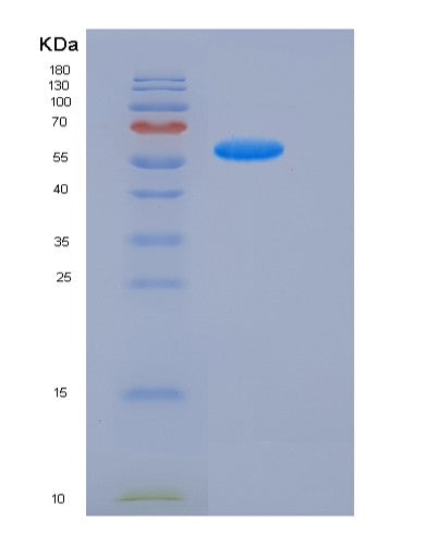 Human PSAP (Prosaposin) - Recombinant Protein