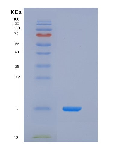Human CD164 (Sialomucin Core Protein 24) - Recombinant Protein