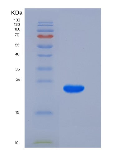 Human KRAS (Gtpase Kras) - Recombinant Protein