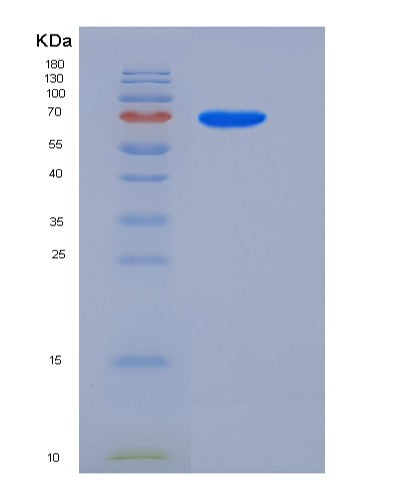Human SEMA6A (Semaphorin-6A) - Recombinant Protein