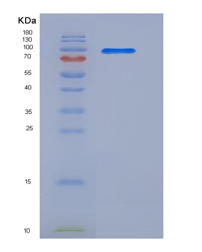 Human SRPK1 (Srsf Protein Kinase 1) - Recombinant Protein