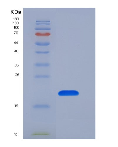 Human GKN1 (Gastrokine-1) - Recombinant Protein
