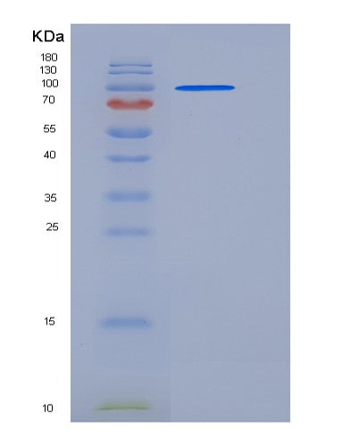 Mouse Aco2 (Aconitate Hydratase, Mitochondrial) - Recombinant Protein