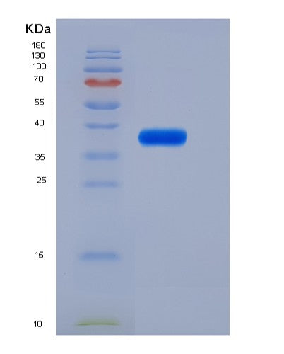 Mouse Il6ra (Interleukin-6 Receptor Subunit Alpha) - Recombinant Protein
