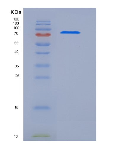 Human MEGF10 (Multiple Epidermal Growth Factor-Like Domains Protein 10) - Recombinant Protein