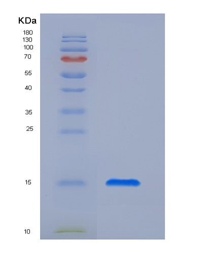Human CTLA4 (Cytotoxic T-Lymphocyte Protein 4) - Recombinant Protein