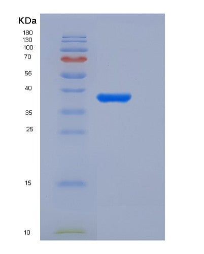 Human ACYP2 (Acylphosphatase-2) - Recombinant Protein
