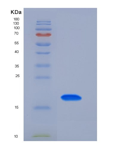 Mouse Tfpi2 (Tissue Factor Pathway Inhibitor 2) - Recombinant Protein