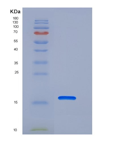 Human PDZD11 (Pdz Domain-Containing Protein 11) - Recombinant Protein