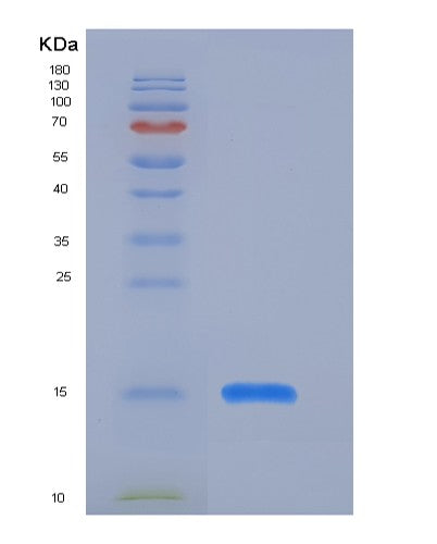 Human PSAP (Prosaposin) - Recombinant Protein