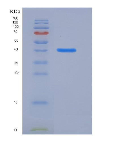 Mouse Hdac8 (Histone Deacetylase 8) - Recombinant Protein