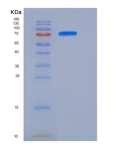 Mouse Meltf (Melanotransferrin) - Recombinant Protein
