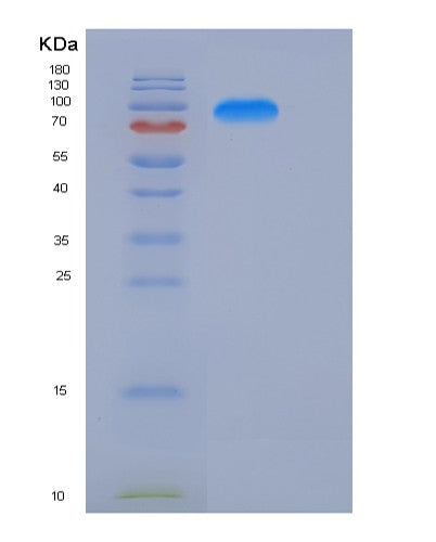 Human KIFBP (Kif-Binding Protein) - Recombinant Protein