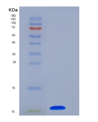 Human COL6A3 (Collagen Alpha-3(Vi) Chain) - Recombinant Protein
