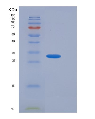 Human ACBD6 (Acyl-Coa-Binding Domain-Containing Protein 6) - Recombinant Protein