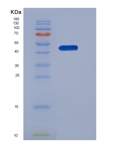 Human SERPINI1 (Neuroserpin) - Recombinant Protein