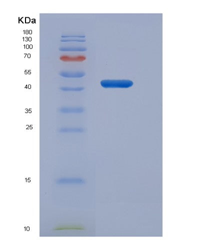 Human LIPF (Gastric Triacylglycerol Lipase) - Recombinant Protein