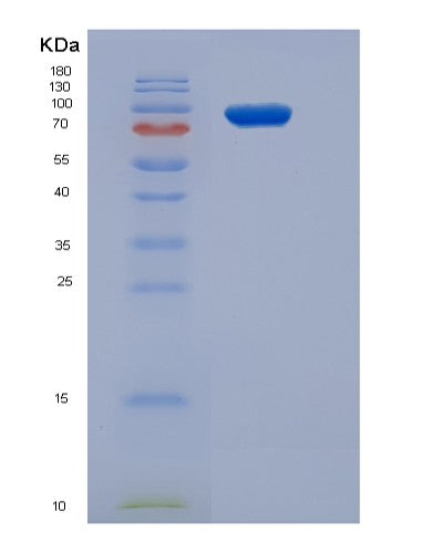 Human SRPK3 (Srsf Protein Kinase 3) - Recombinant Protein