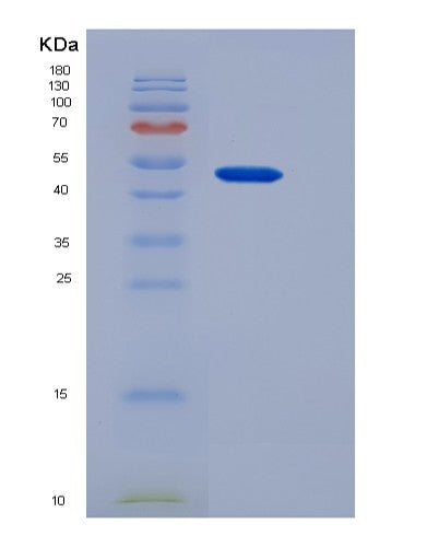 Human SSTR1 (Somatostatin Receptor Type 1) - Recombinant Protein