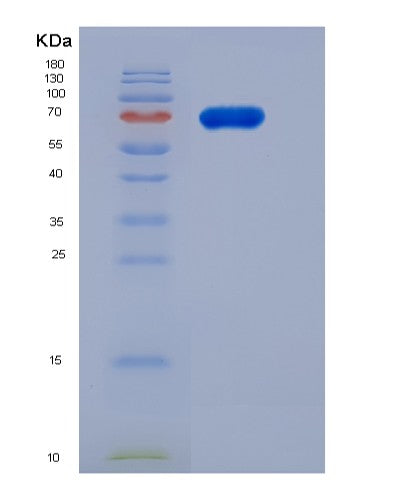 Human FAM20B (Glycosaminoglycan Xylosylkinase) - Recombinant Protein