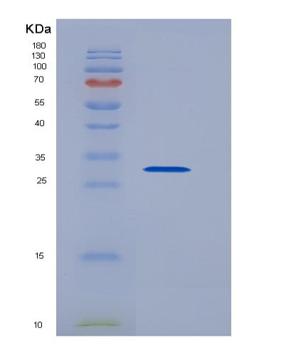 Human STATH (Statherin) - Recombinant Protein