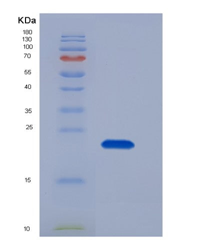 Human RAC2 (Ras-Related C3 Botulinum Toxin Substrate 2) - Recombinant Protein