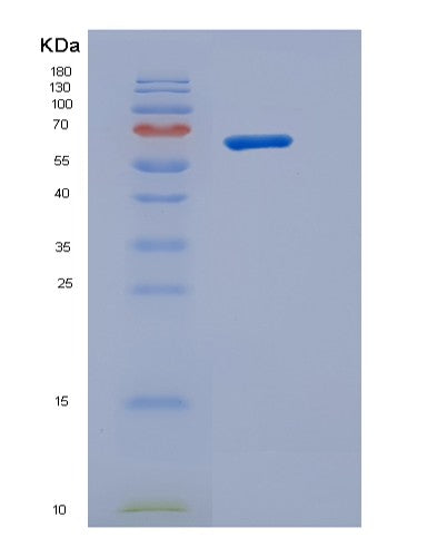 Human RP2 (Protein Xrp2) - Recombinant Protein