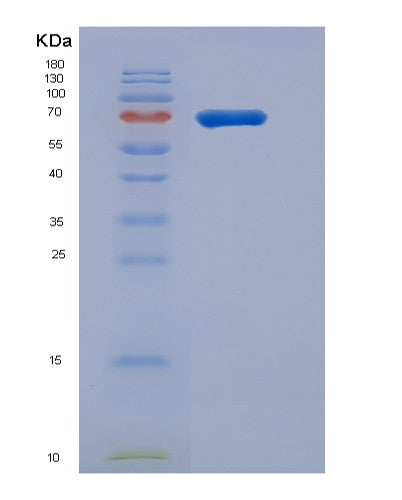 Mouse Vnn1 (Pantetheinase) - Recombinant Protein