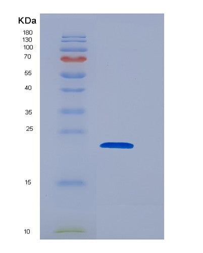 Human PPP3R1 (Calcineurin Subunit B Type 1) - Recombinant Protein