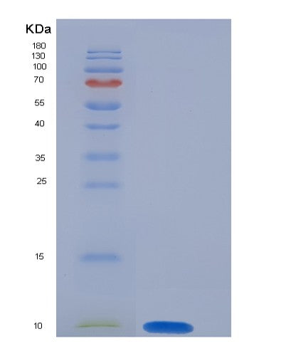 Mouse S100a6 (Protein S100-A6) - Recombinant Protein