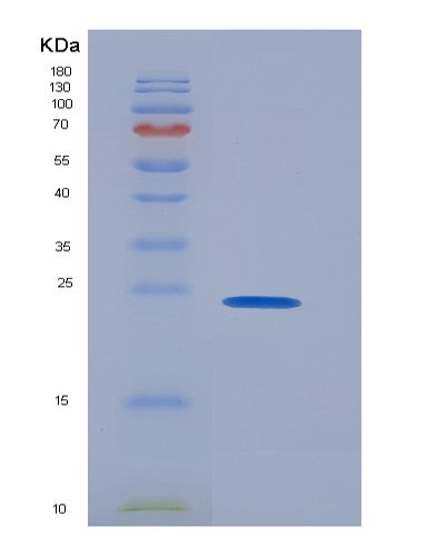 Human TMUB2 (Transmembrane And Ubiquitin-Like Domain-Containing Protein 2) - Recombinant Protein