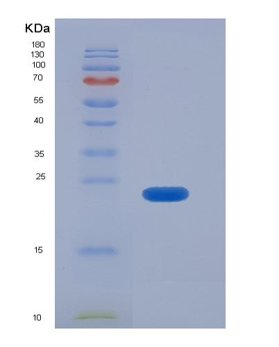 Human RAB31 (Ras-Related Protein Rab-31) - Recombinant Protein