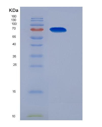 Mouse Ncstn (Nicastrin) - Recombinant Protein