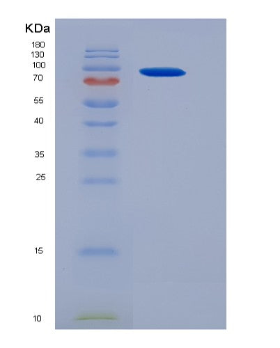 Mouse Ncstn (Nicastrin) - Recombinant Protein