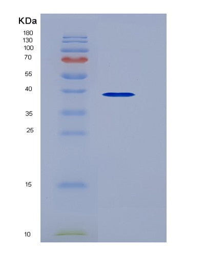 Human GPD1 (Glycerol-3-Phosphate Dehydrogenase [Nad(+)], Cytoplasmic) - Recombinant Protein