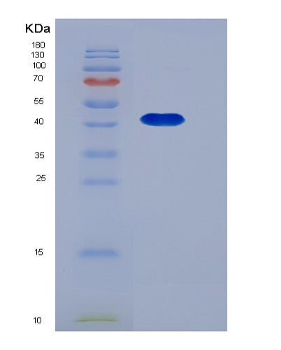 Mouse Serpinb8 (Serpin B8) - Recombinant Protein