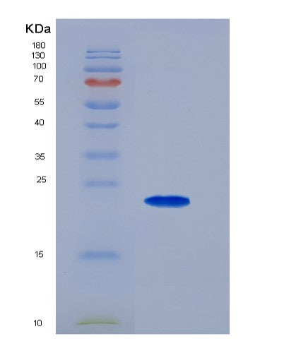 Human EDNRB (Endothelin Receptor Type B) - Recombinant Protein