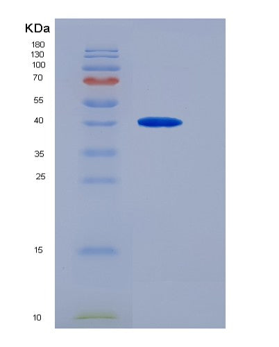 Human NTS (Neurotensin/Neuromedin N) - Recombinant Protein