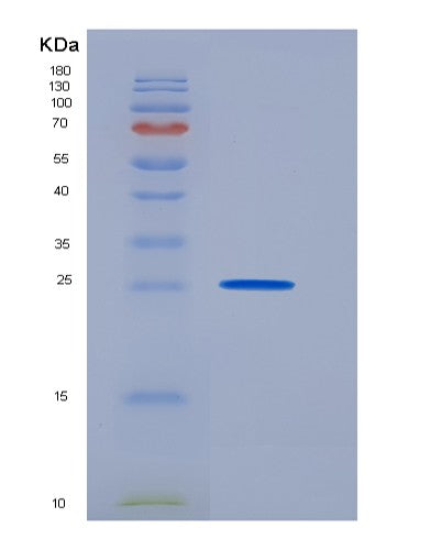Human PARM1 (Prostate Androgen-Regulated Mucin-Like Protein 1) - Recombinant Protein