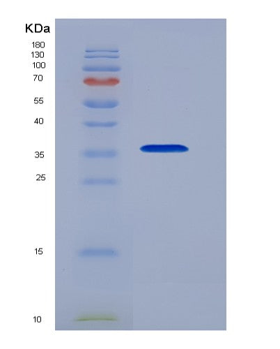 Human NFKBIA (Nf-Kappa-B Inhibitor Alpha) - Recombinant Protein