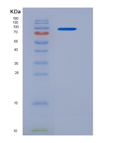 Human PDIA4 (Protein Disulfide-Isomerase A4) - Recombinant Protein