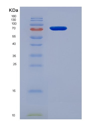 Mouse Ccne1 (G1/S-Specific Cyclin-E1) - Recombinant Protein