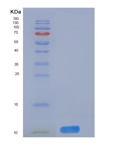 Human DNAJC30 (Dnaj Homolog Subfamily C Member 30, Mitochondrial) - Recombinant Protein