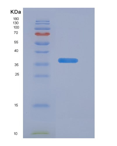 Human CALCB (Calcitonin Gene-Related Peptide 2) - Recombinant Protein