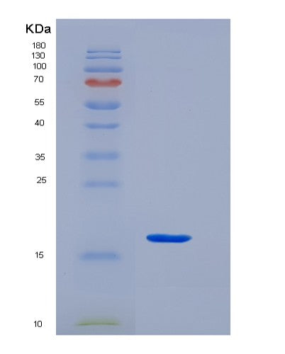 Human KCT2 (Keratinocyte-Associated Transmembrane Protein 2) - Recombinant Protein
