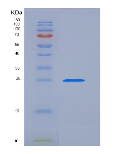 Mouse Il10rb (Interleukin-10 Receptor Subunit Beta) - Recombinant Protein